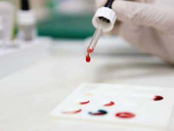 Tylus vyrų žudikas ‒ prostatos vėžys