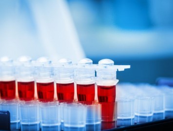 Prostatos specifinis antigenas. PSA testo privalumai ir trūkumai