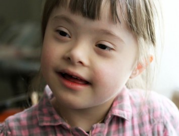 Dauno sindromo tikimybė ir diagnostiniai tyrimai