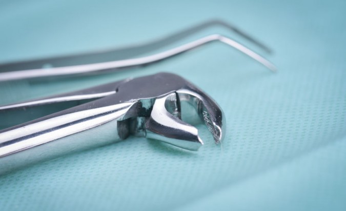 „Dental P.R.O.“: kada prireikia burnos chirurgijos?