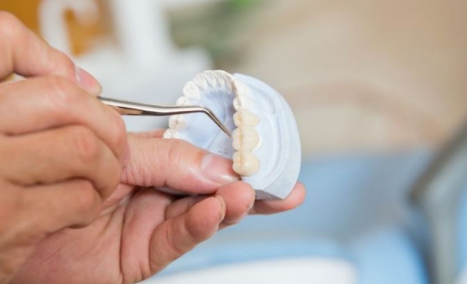 Kaip išvengti periodontito ir turėti sveikus dantis?