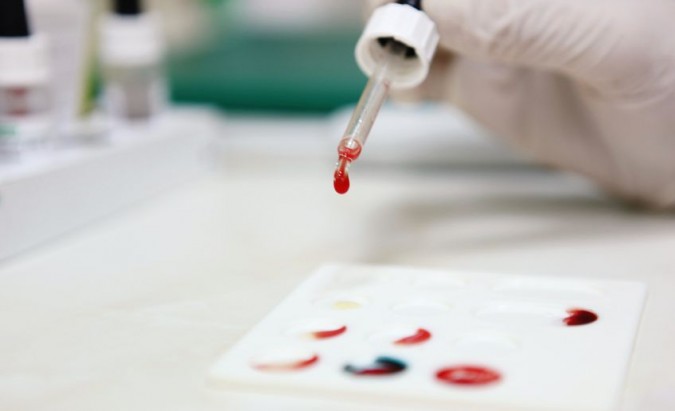 Tylus vyrų žudikas ‒ prostatos vėžys