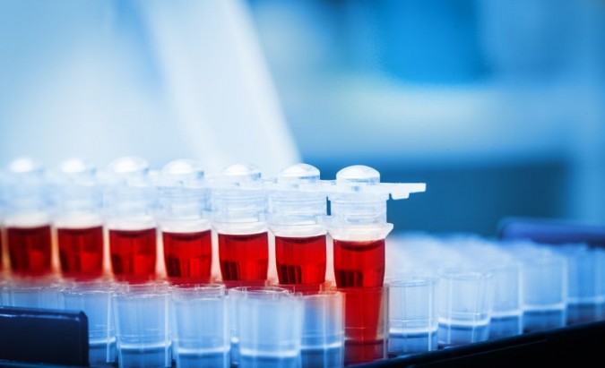 Prostatos specifinis antigenas. PSA testo privalumai ir trūkumai