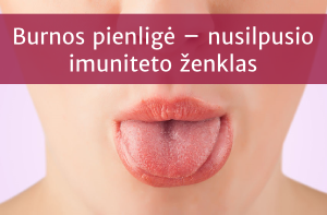 Burnos pienligė – nusilpusio imuniteto ženklas