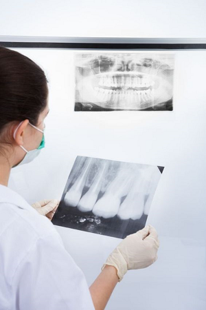 Dantų rovimas nėra skausmingas, bet gijimas gali būti sudėtingesnis