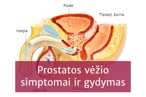 hipertenzija ir prostatos vėžys)