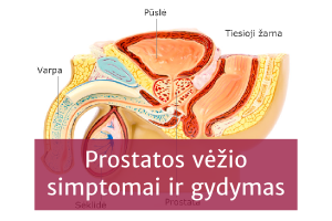 Prostatos vėžys