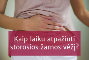 Kaip laiku atpažinti storosios žarnos vėžį?